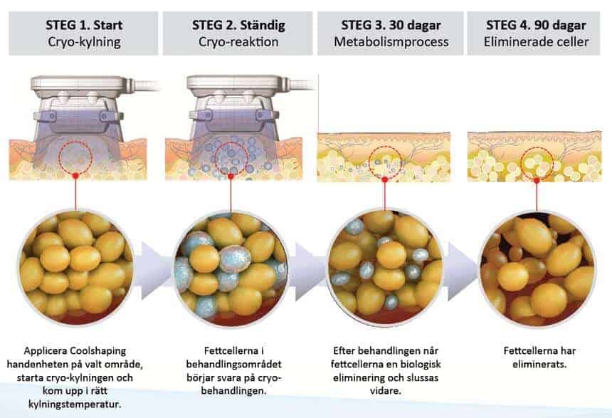 Coolshaping/Fettfrysning 3 coolshaping steg